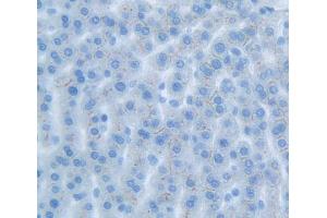 Figure. (IL17 Receptor B antibody  (AA 166-354))