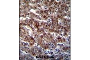 Immunohistochemistry (Paraffin-embedded Sections) (IHC (p)) image for anti-Aspartyl-tRNA Synthetase (DARS) (AA 154-183), (N-Term) antibody (ABIN655040)