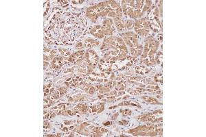 Immunohistochemical analysis of (ABIN391830 and ABIN2841673) on paraffin-embedded Human kidney tissue. (HSP70 1A antibody  (AA 19-48))
