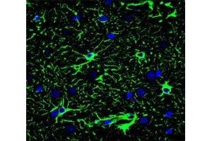 Confocal immunofluorescent analysis of GFAP antibody with brain tissue followed by Alexa Fluor 488-conjugated goat anti-mouse lgG (green). (GFAP antibody)