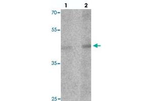 Western blot analysis of LMX1A in rat brain tissue with LMX1A polyclonal antibody  at (1) 1 and (2) 2 ug/mL. (LMX1A antibody  (C-Term))