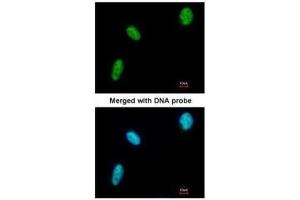 ICC/IF Image Immunofluorescence analysis of paraformaldehyde-fixed HeLa, using DDX39, antibody at 1:200 dilution. (BAT1 antibody  (Center))