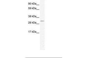 Image no. 1 for anti-Doublesex and Mab-3 Related Transcription Factor 2 (DMRT2) (AA 461-510) antibody (ABIN202258)