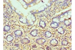 Immunohistochemistry of paraffin-embedded human small intestine tissue using ABIN7155972 at dilution of 1:100