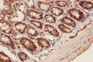 Anti-Beclin 1 Picoband antibody,  IHC(P): Rat Intestine Tissue (Beclin 1 antibody  (AA 1-354))
