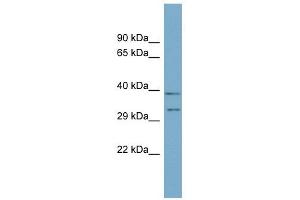 DPPA4 antibody used at 1 ug/ml to detect target protein.