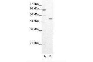 Image no. 1 for anti-Zinc Finger Protein 665 (ZNF665) (AA 76-125) antibody (ABIN202995) (ZNF665 antibody  (AA 76-125))