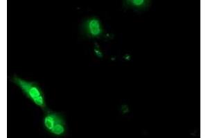 Anti-EPM2AIP1 mouse monoclonal antibody (ABIN2452994) immunofluorescent staining of COS7 cells transiently transfected by pCMV6-ENTRY EPM2AIP1 (RC209239). (EPM2AIP1 antibody)