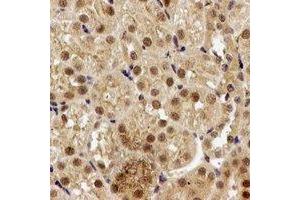 Immunohistochemical analysis of PPP2R2A staining in rat kidney formalin fixed paraffin embedded tissue section. (PPP2R2A antibody)