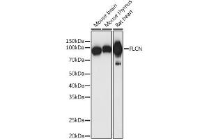 Western blot analysis of extracts of various cell lines, using FLCN antibody (ABIN7267226) at 1:1000 dilution. (FLCN antibody  (AA 1-130))