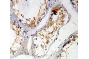 Used in DAB staining on fromalin fixed paraffin-embedded Testis tissue (KIAA1524 antibody  (AA 230-560))