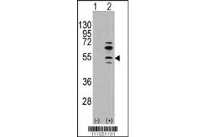 Western blot analysis of MEF2C using rabbit polyclonal MEF2C Antibody (S59) using 293 cell lysates (2 ug/lane) either nontransfected (Lane 1) or transiently transfected with the MEF2C gene (Lane 2). (MEF2C antibody  (AA 37-66))