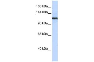 WB Suggested Anti-PLA2G4B Antibody Titration:  0. (PLA2G4B antibody  (N-Term))