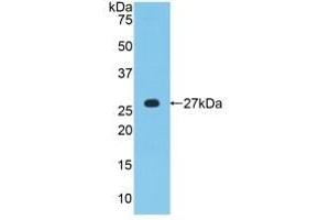 Detection of Recombinant MPZ, Human using Polyclonal Antibody to Protein Zero, Myelin (MPZ) (MPZ antibody  (AA 30-248))