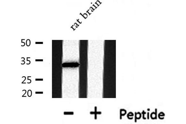 DHRS4 antibody  (C-Term)