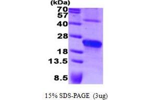 SDS-PAGE (SDS) image for Syndecan 4 (SDC4) (AA 19-145) protein (ABIN668053) (SDC4 Protein (AA 19-145))