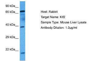 Host: Mouse Target Name: KLF2 Sample Tissue: Mouse Liver Antibody Dilution: 1ug/ml (KLF2 antibody  (N-Term))