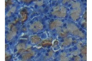 Detection of CTRC in Rat Pancreas Tissue using Polyclonal Antibody to Chymotrypsin C (CTRC) (Elastase 4 antibody  (AA 30-268))