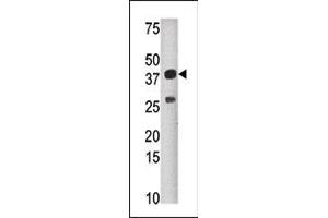 Western blot analysis of anti-SULT1C2 Pab (ABIN389140 and ABIN2839315) in mouse liver tissue lysate (35 μg/lane). (SULT1C2 antibody  (N-Term))