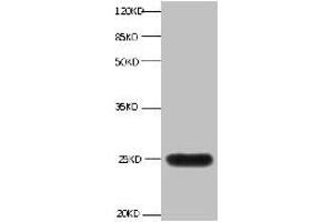 All lanes:Mouse anti-human Neutrophil gelatinase-associated lipocalin monoclonal antibody at 1 μg/mL Lane 1:NGAL transfected 293 cell lysate Predicted band size : 22 kDa Observed band size : 25 kDa (Lipocalin 2 antibody)