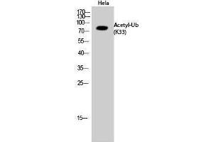Western Blotting (WB) image for anti-Ubiquitin (Ubiquitin) (acLys33) antibody (ABIN3181498) (Ubiquitin antibody  (acLys33))
