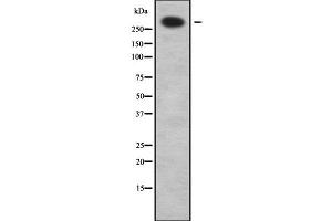 Western blot analysis of ABCA12 using LOVO whole cell lysates (ABCA12 antibody  (C-Term))