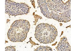 ABIN7095984 and ABIN7100046 at 1/100 staining mouse testis tissue by IHC-P. (BCL2-Like 15 antibody)