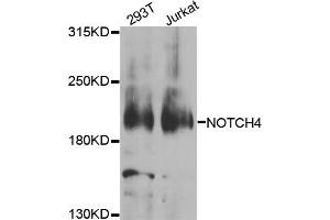 Western blot analysis of extracts of various cell lines, using NOTCH4 antibody (ABIN5974822) at 1/1000 dilution. (NOTCH4 antibody)