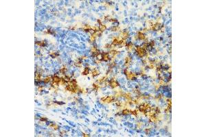 Immunohistochemistry of paraffin-embedded rat spleen using CD3D antibody (ABIN3021813, ABIN3021814, ABIN3021815 and ABIN6215992) at dilution of 1:200 (40x lens).