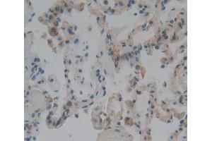 Used in DAB staining on fromalin fixed paraffin- embedded lung tissue (CENPJ antibody  (AA 1-207))