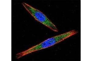 Confocal immunofluorescent analysis of LCK antibody with A2058 cells followed by Alexa Fluor 488-conjugated goat anti-rabbit lgG (green). (LCK antibody  (AA 23-52))