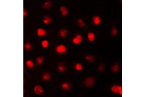 Immunofluorescent analysis of RB1 staining in COLO205 cells. (Retinoblastoma 1 antibody  (C-Term))