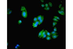 Immunofluorescent analysis of HepG2 cells using ABIN7141994 at dilution of 1:100 and Alexa Fluor 488-congugated AffiniPure Goat Anti-Rabbit IgG(H+L) (MICAL2 antibody  (AA 1-495))