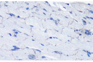 Immunohistochemistry of paraffin-embedded Mouse heart using Phospho-P70 S6K(T389) Polyclonal Antibody at dilution of 1:100 (40x lens). (RPS6KB1 antibody  (pThr389))