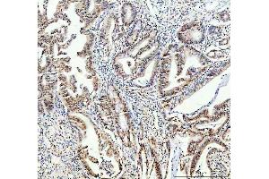 IHC analysis of FTO using anti-FTO antibody (ABIN7601059).