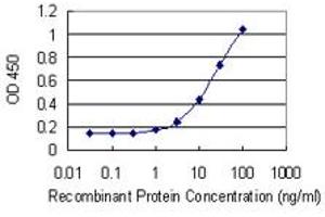 Detection limit for recombinant GST tagged KLK2 is 0. (Kallikrein 2 antibody  (AA 1-262))