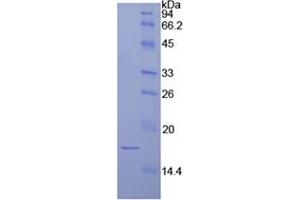 SDS-PAGE analysis of Human Laminin alpha 1 Protein. (Laminin alpha 1 Protein)