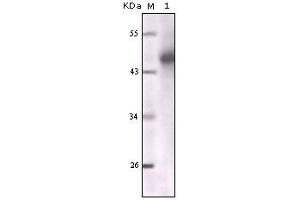 Western blot analysis using CK mouse mAb against truncated CK5 recombinant protein. (Cytokeratin 1 antibody)
