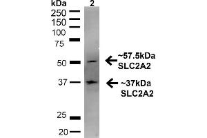 Western blot analysis of Rat Liver showing detection of ~57.