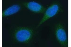 IF analysis of VAPA using anti-VAPA antibody (ABIN7603249). (VAPA antibody  (N-Term))