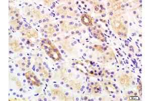 Formalin-fixed and paraffin embedded rat kidney labeled with Rabbit Anti Insulin Receptor Beta Polyclonal Antibody, Unconjugated (ABIN727340) at 1:200 followed by conjugation to the secondary antibody and DAB staining (ISR-beta antibody  (AA 1001-1100))