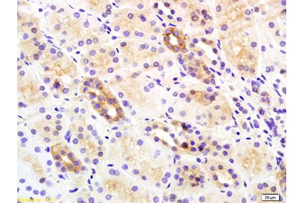 ISR-beta antibody  (AA 1001-1100)