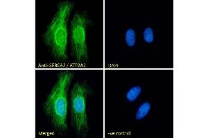 (ABIN1686784) mmunofluorescence analysis of paraformaldehyde fixed HeLa cells, permeabilized with 0. (ATP2A2 antibody  (Internal Region))