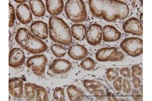 Image no. 2 for anti-P21-Activated Kinase 1 (PAK1) (AA 191-280) antibody (ABIN598852) (PAK1 antibody  (AA 191-280))