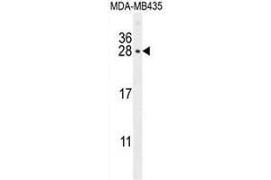CSH1 Antibody (C-term) western blot analysis in MDA-MB435 cell line lysates (35µg/lane). (CSH1 antibody  (C-Term))