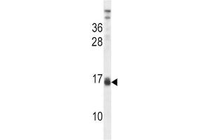 Western Blotting (WB) image for anti-Lactalbumin, alpha- (LALBA) antibody (ABIN2998275) (LALBA antibody)