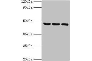 Western blot All lanes: SYT11 antibody at 14 μg/mL Lane 1: COLO205 whole cell lysate Lane 2: Mouse skeletal muscle tissue Lane 3: MCF-7 whole cell lysate Secondary Goat polyclonal to rabbit IgG at 1/10000 dilution Predicted band size: 48 kDa Observed band size: 48 kDa (SYT11 antibody  (AA 37-200))