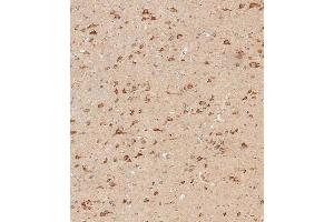 Immunohistochemistry (Paraffin-embedded Sections) (IHC (p)) image for anti-Interferon alpha/beta Receptor 1 (IFNAR1) (AA 162-188) antibody (ABIN652490)