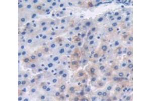 IHC-P analysis of Kidney tissue, with DAB staining. (MT1 antibody)