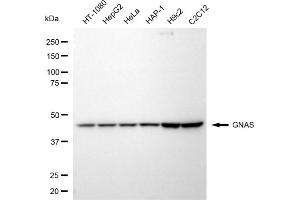 Western blotting analysis using GNAS antibody (ABIN7798790).